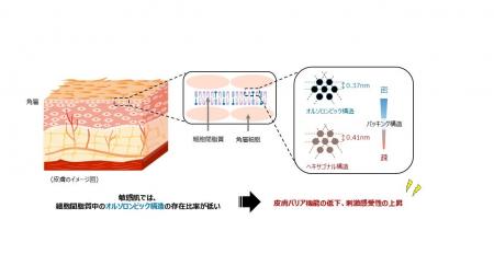 皮膚バリア機能が低下傾向にある敏感肌とセラミドの実