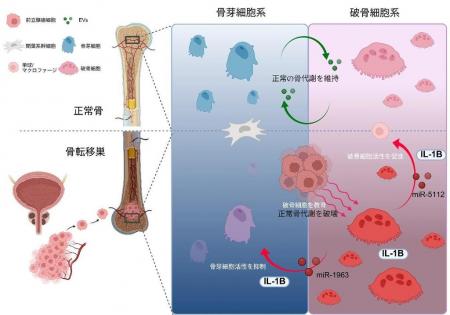 【東京医科大学】悪性化破骨細胞由来の細胞外小utf-8