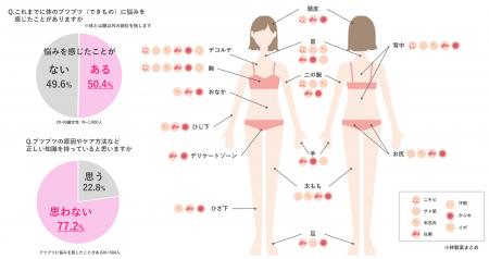 それってニキビじゃないかも？“ からだの部位 ”や“ ブ