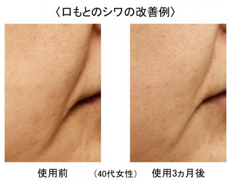 霊芝の亜臨界水抽出物が肌のDNA修復能力を高め、様々