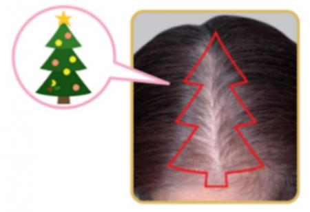 夏本番!強い日差し、髪・頭皮の○○談を教えて! 夏本番!強い日差し、髪・頭皮の○○談を教えて!