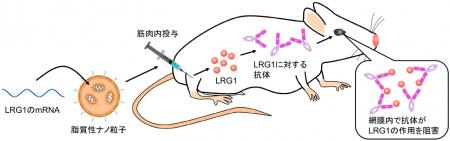 【横浜市立大学】mRNAワクチンで進行性の眼の病utf-8