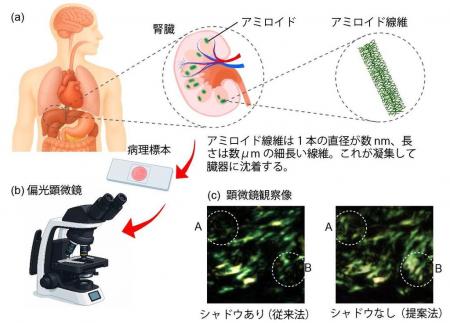 【埼玉医科大学・宇都宮大学】「影のない画像」utf-8