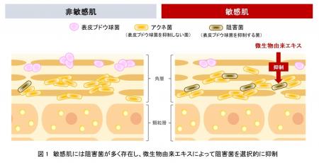 資生堂、菌叢研究を通じて敏感肌には表皮ブドウ球菌の