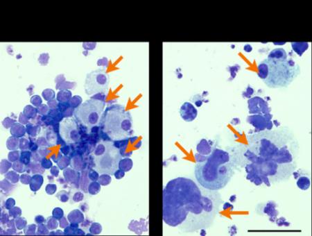 【東京薬科大学】既存肺がん治療薬クリゾチニブutf-8