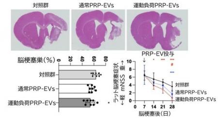 脳梗塞後の回復を促す新たな治療法の可能性