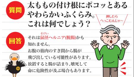 知っていますか？「予防できない」鼠径ヘルニア（脱腸
