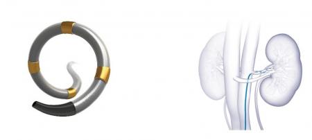 日本メドトロニック　高血圧治療を行うデバイス「Symp