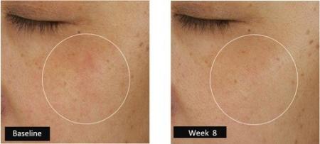 睡眠の日に寄せて ― エスティ ローダー、初の「睡眠不