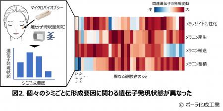 シミごとに形成要因は異なっていた シミごとに形成要因は異なっていた