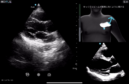 GEヘルスケア・ジャパン、超音波診断装置「Vscan」シ GEヘルスケア・ジャパン、超音波診断装置「Vscan」シ