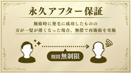 サイゼン毛髪再生総合センター*が『永久アフター保証 サイゼン毛髪再生総合センター*が『永久アフター保証