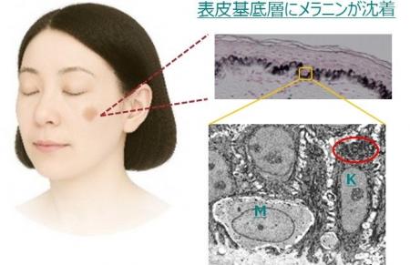 老化細胞が「掃除機」のようにメラニンを取り込む新事
