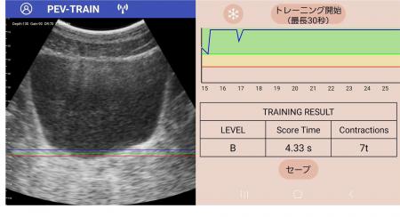 スマホで自分の骨盤底を見ながら「骨盤底トレーニング