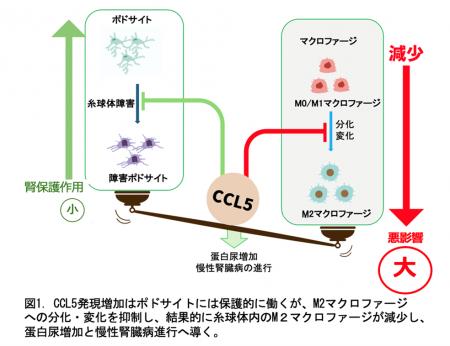 慢性腎臓病が進行するメカニズムの一端を解明～ケモカ
