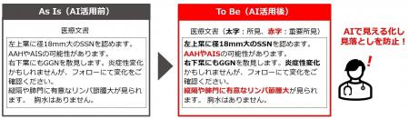 インテック、岩手医科大学と共同で医療文書の見落とし インテック、岩手医科大学と共同で医療文書の見落とし