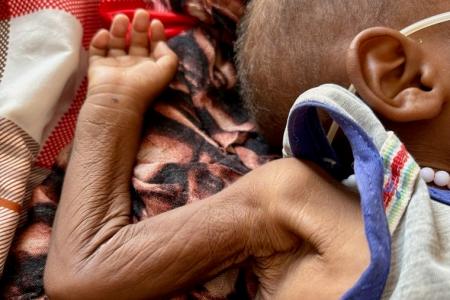 スーダン：長引く紛争で極度の栄養失調が広がる──人道