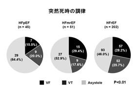 心不全タイプ“HFpEF”における突然死の新たなメカutf-8 心不全タイプ“HFpEF”における突然死の新たなメカutf-8