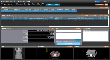 医療被ばくの最適化を支援する線量管理システム、日本