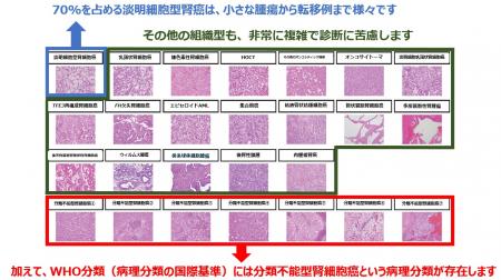 【横浜市立大学】国際標準をめざした腎癌診断支utf-8