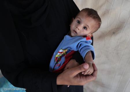 ガザ地区の妊産婦に深刻な栄養不良 「生まれる前から ガザ地区の妊産婦に深刻な栄養不良 「生まれる前から