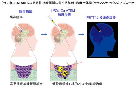【横浜市立大学】悪性脳腫瘍に対する“低酸素領域utf-8