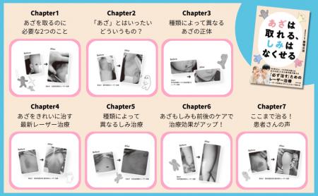 『あざは取れる、しみはなくせる』刊行 ― レーザー治