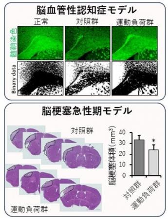 運動が脳を守る新たな仕組みを解明