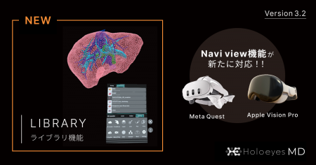 Holoeyes、医療用画像処理ソフトウェア「Holoeyes MD