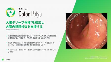 大腸ポリープ候補を検出し大腸内視鏡検査を支援する「 大腸ポリープ候補を検出し大腸内視鏡検査を支援する「