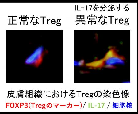 免疫系細胞の異常が皮膚の老化を促進する新たなメカニ 免疫系細胞の異常が皮膚の老化を促進する新たなメカニ