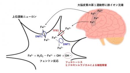 ALSに対する水素吸入療法の新たな可能性