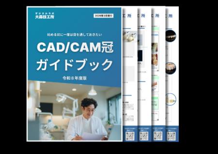 「PEEK冠しか適用できないと思いきや...」デジタルラ