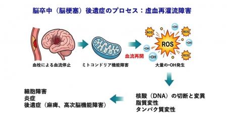 低濃度水素吸入が脳卒中後遺症を抑制する可能性