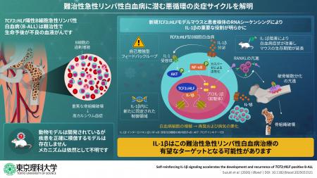 難治性急性リンパ性白血病、悪化の鍵を握る因子を特定