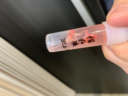 “最先端”の幹細胞で関節の痛みを治す「お茶の水セルク