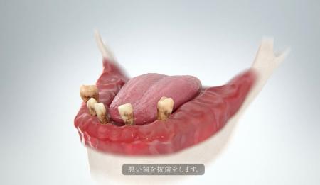 入れ歯の時代が終わる。歯科界に革命をもたらす新治療