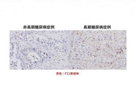 弘前大学の水上浩哉教授らの研究グループが長期utf-8