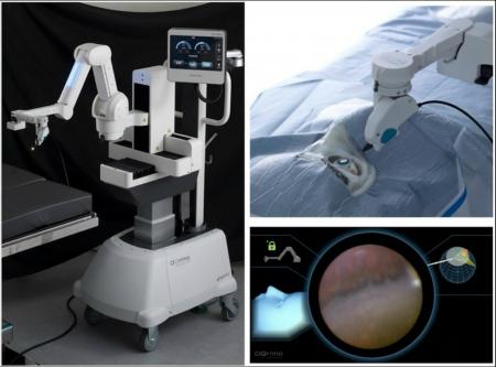 眼内内視鏡保持ロボット「OQrimo」による強膜圧迫を行