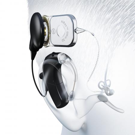 補聴器のマキチエ　人工内耳の開発・製造を行うアドバ