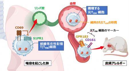組織常在性T細胞が“炎症記憶”を保持し全身へ波及 ～全