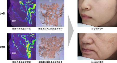 資生堂、加齢による深部血管の血流バランスの崩れが肌