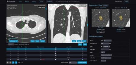 【米国 SelectUSAで世界第3位】台湾発の医療AIスター
