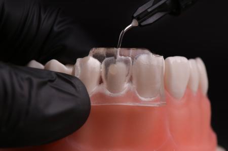 「健康な歯を削らない治療」の普及を背景にamidexがプ