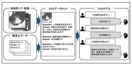 【名城大学】CT画像×AI対話で所見自動生成　肺がutf-8