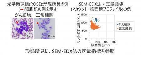 肺がん検査支援に向けて、走査電子顕微鏡観察とエネル