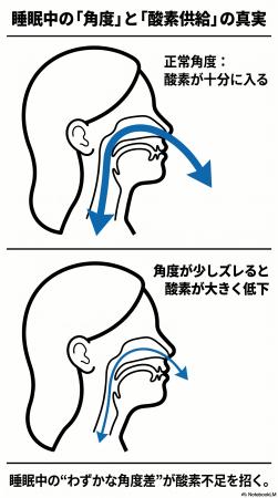 「医学の死角。血糖値・中性脂肪は“睡眠中の酸素不足”