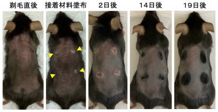 たった一滴塗るだけで完全に毛が生える方法を発見　～