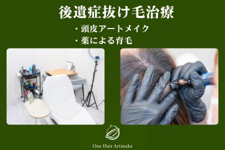 頭皮アートメイクによる「後遺症抜け毛治療」。放射線