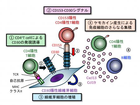 【徳島大学】自己免疫疾患の進行を加速する新メカニズ